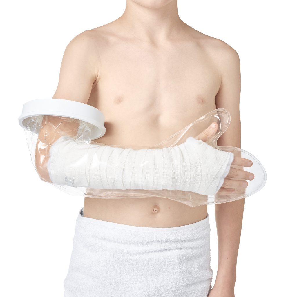 Gips Ruka Zaštitni rukav za gips za dečiju ruku - Medisport